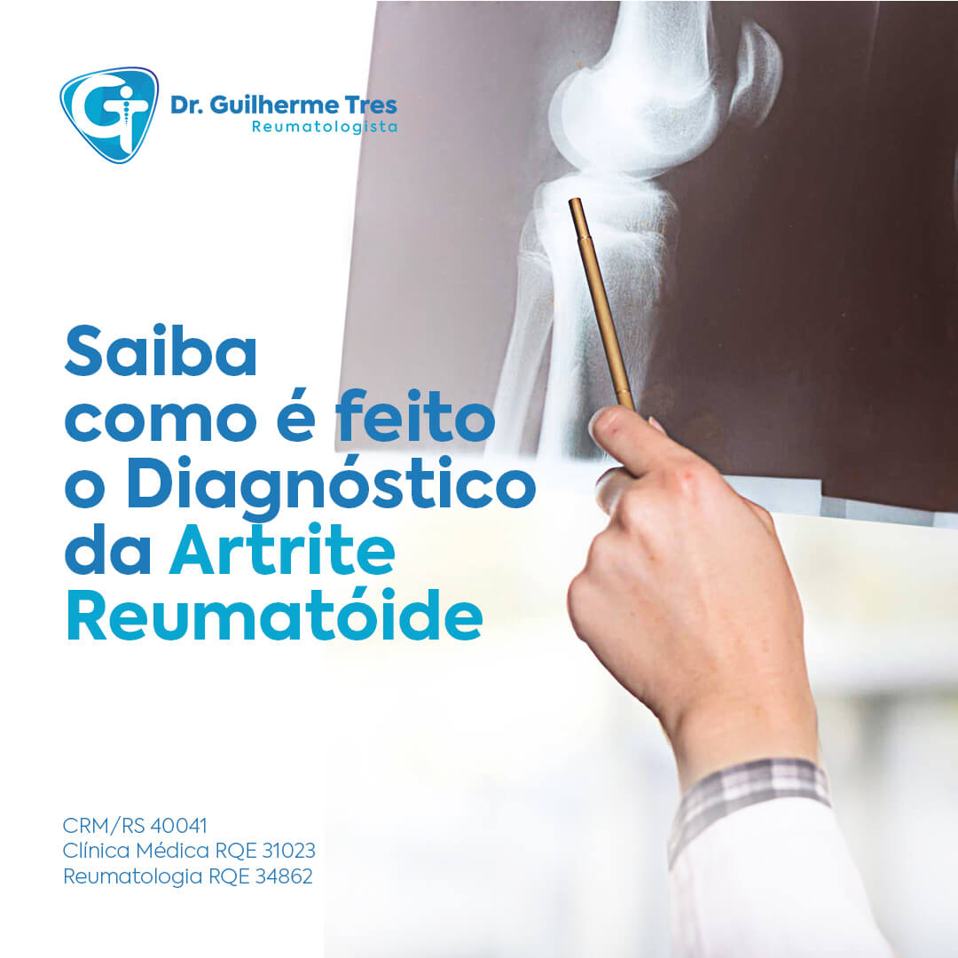 Saiba como é feito o Diagnóstico da Artrite Reumatóide - Dr Guilherme Tres